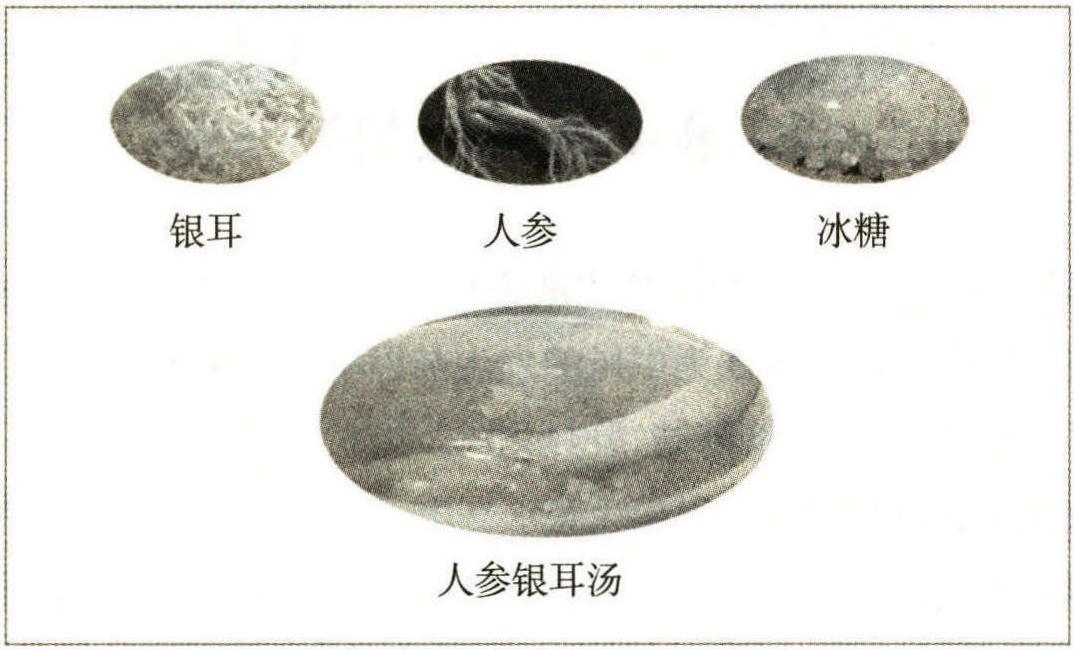 胸痹心痛(冠心病)